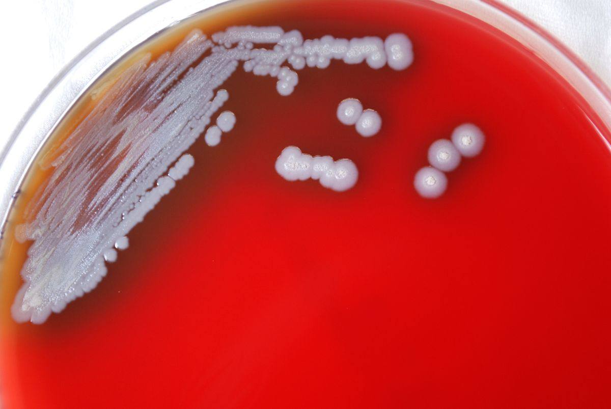 File photo of a petri plate with colonies of Burkholderia pseudomallei, the soil bacterium that causes melioidosis (US CDC via AP)